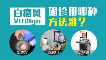 县级医院能辨别出白斑是不是白癜风吗