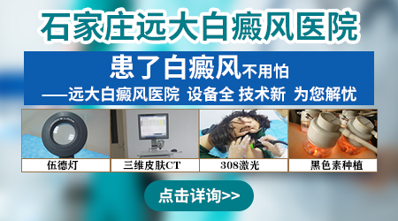 白斑能治好吗 哪些方法可以治疗白斑