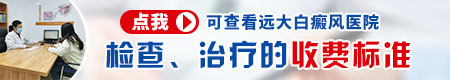 白癜风医院治疗费用可以报销吗