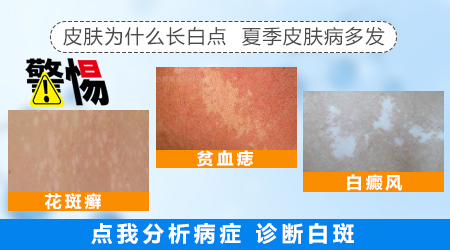 大腿内侧白斑点是什么原因