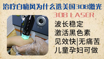 用什么药膏可以治疗白斑