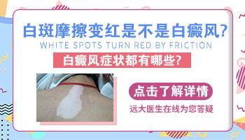 白癜风是不是搓搓会红