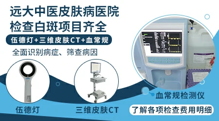 伍德灯照白癜风出现瓷白色是什么情况