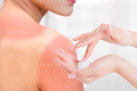 晒太阳白斑不发红能不能排除白癜风