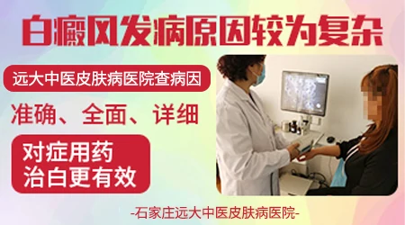 石家庄哪里能查清楚白斑的发病原因