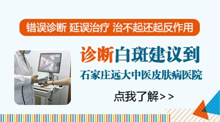 皮肤白斑 白斑专科正规医院