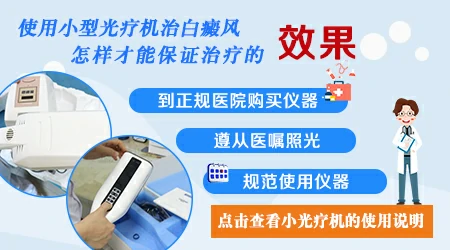 白癜风选家用光疗仪怎么选适合自己的