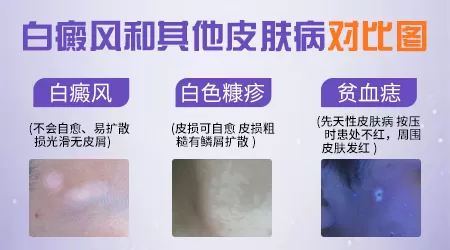 小孩手背长小白点图