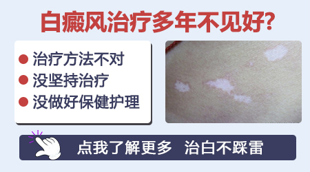 石家庄看白癜风专科医院排名