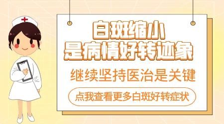 白癜风初期一般光疗几次就会有效果