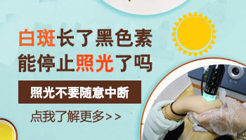 308激光照白癜风一般照到什么样就可以停止了