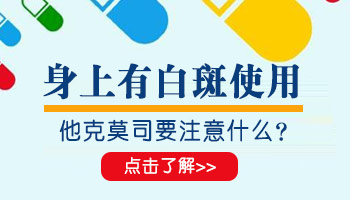 白癜风能不能抹他克莫司