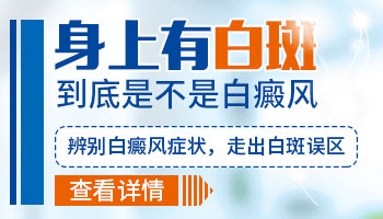 四岁宝宝身上一小块皮肤特别白是得了白癜风吗