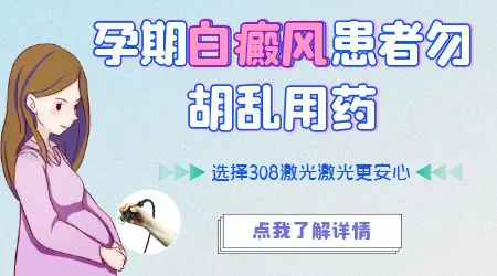 孕妇得了白癜风能正常接受治疗吗