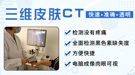 伍德灯结果显示白斑呈灰白色严重吗
