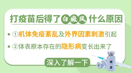疫苗打完后会得白癜风吗