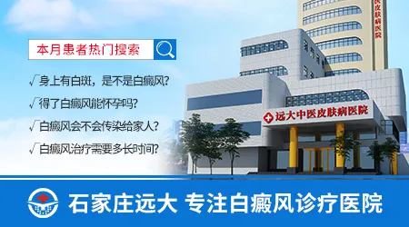 石家庄本地看白癜风医院性价比排名