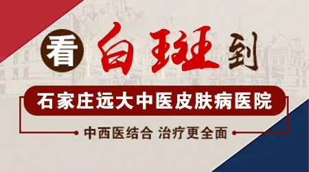 白癜风补骨脂酊一天擦几次好