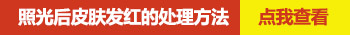 脸部白癜风照了311一直红怎么回事