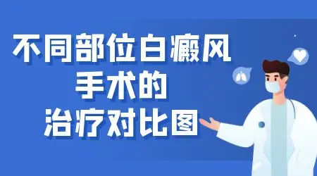 手部白癜风黑色素移植手术恢复不好怎么办
