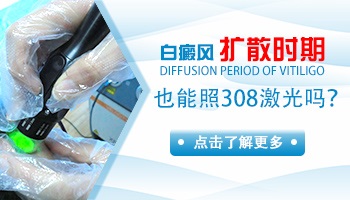 白癜风在扩展期照308光有用吗