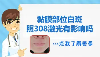 进口激光和家用光疗机区别 哪个机子照白斑好