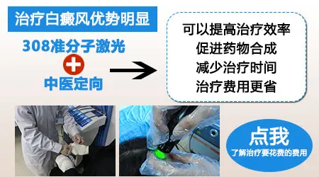 白癜风308激光照光两个月没效果那怎么办