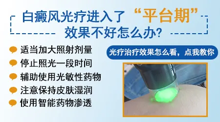 白癜风光疗连续3个月没效果还要继续吗