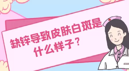 孩子缺锌脸上白斑和白癜风白斑的区别