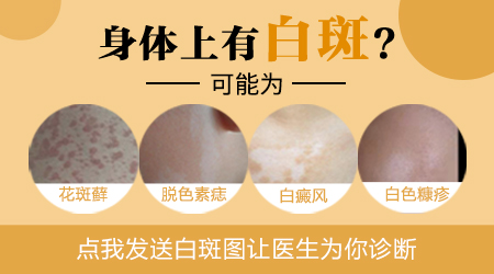 胸部有一块皮肤变白是什么原因