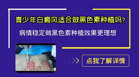 黑色素细胞移植手术要多少钱