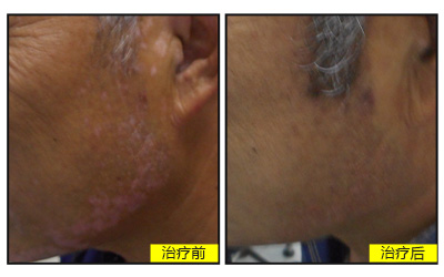 石家庄远大白斑医院可靠吗