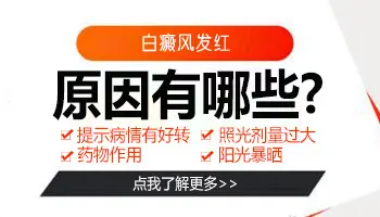 白癜风擦药后发红是正常的吗