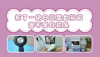 儿童大腿夹缝处发白是不是得了白癜风