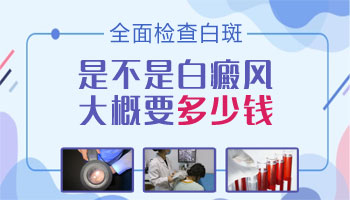 孩子胸口就有一块瓷白色的斑点是白癜风吗