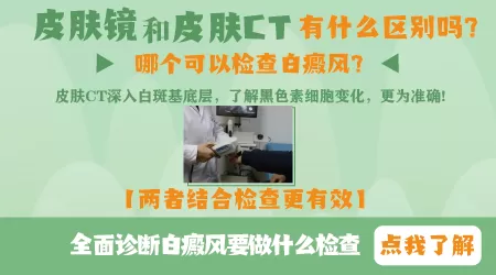 皮肤CT和皮肤镜的区别