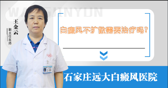 白癜风不扩散需要治疗吗