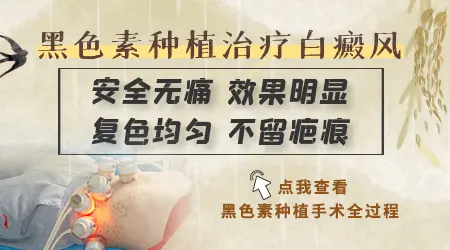 白癜风植皮手术成功率高吗 会不会留疤