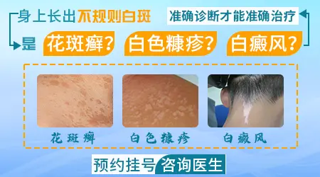 鼻子两侧皮肤有点微白是什么情况