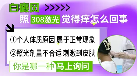 白斑照紫外线光后伴有轻微瘙痒要紧吗