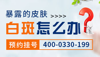 白癜风一般从哪个地方出现