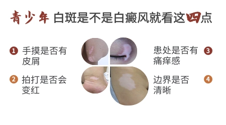 少年脖子上出现一块白怎么回事
