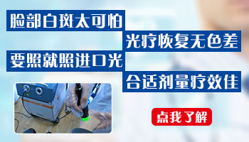 脸上长了白癜风好治吗 要多长时间才能恢复