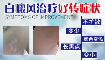 白癜风照308激光白斑开始变黑还需要照多少次