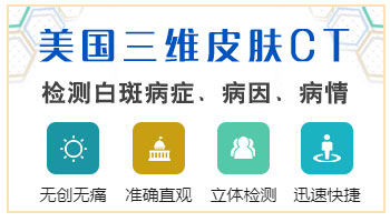 邯郸有没有白癜风三维皮肤ct