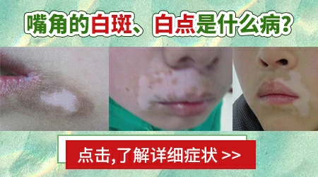 嘴唇边缘白了一圈