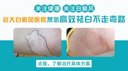 生姜擦拭白癜风的真实案例