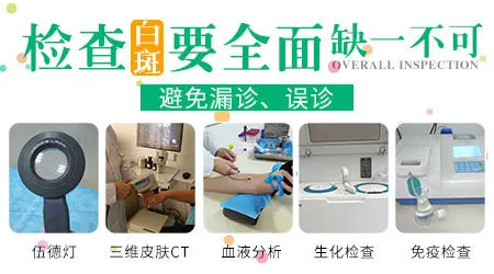 伍德灯检查出错的概率有多少