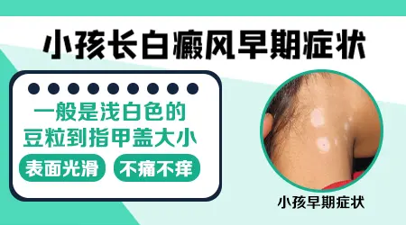 小孩手臂上白癜风早期症状图片
