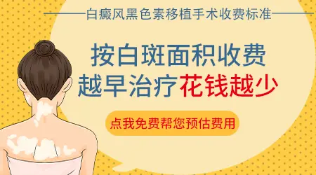 白癜风做黑色素细胞培植术的价格